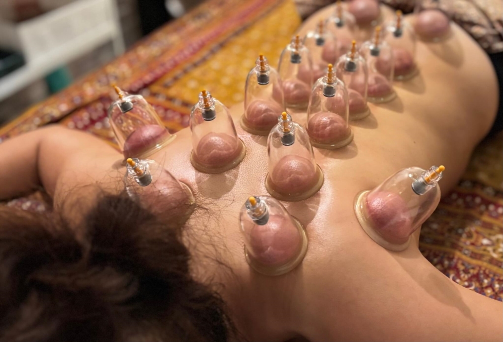 Le soin par les ventouses : une méthode ancestrale