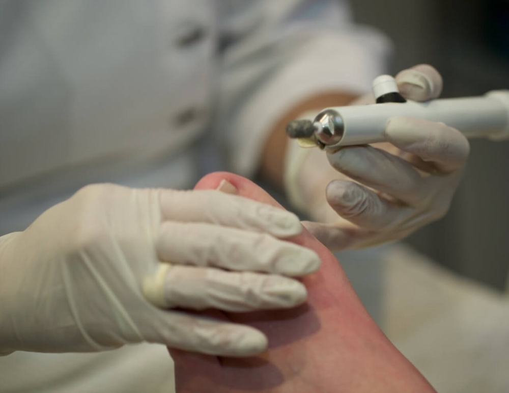 Traitement des ongles à problèmes