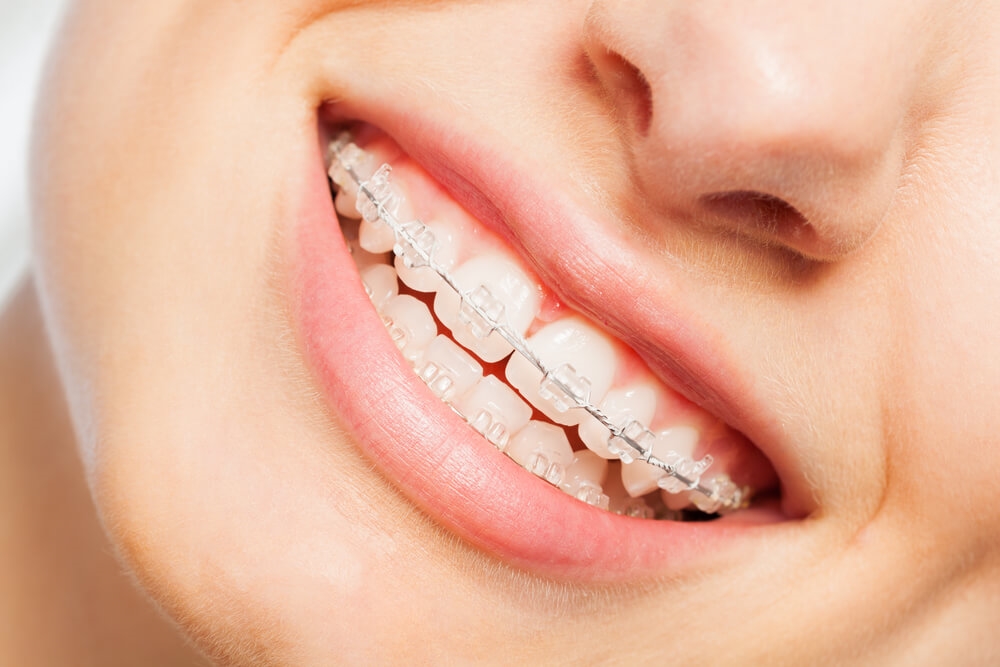 Orthodontie
