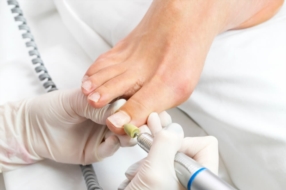 Pédicure – entre soin médical et beauté des pieds