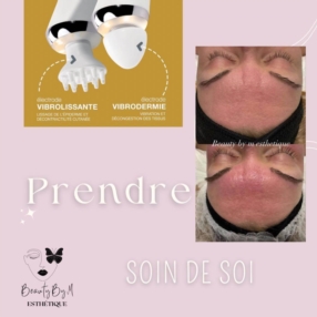 Découvrez la vibrodermie chez Beauty by M Esthétique