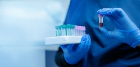 Analyses en laboratoire