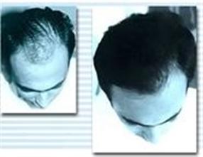 Les masques effectifs des cheveux fouettés