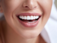 Article fromCabinet Dentaire Dr. Mohseni & Dr. Vinee