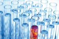 Artikel vonLaboratoire d'Analyses Médicales Ketterthill